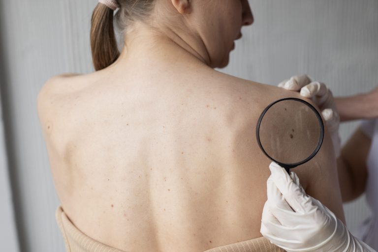 Why is melanoma so dangerous?