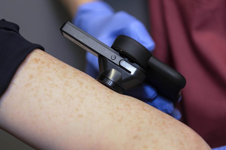 Google skin cancer analysis