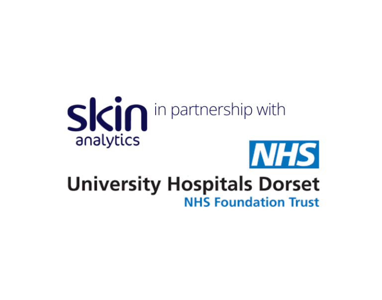 University Hospitals Dorset NHS Foundation Trust launches AI teledermatology for suspected skin cancer with Skin Analytics